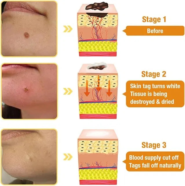 Meltdown Gel Cream for Acne-Prone Skin