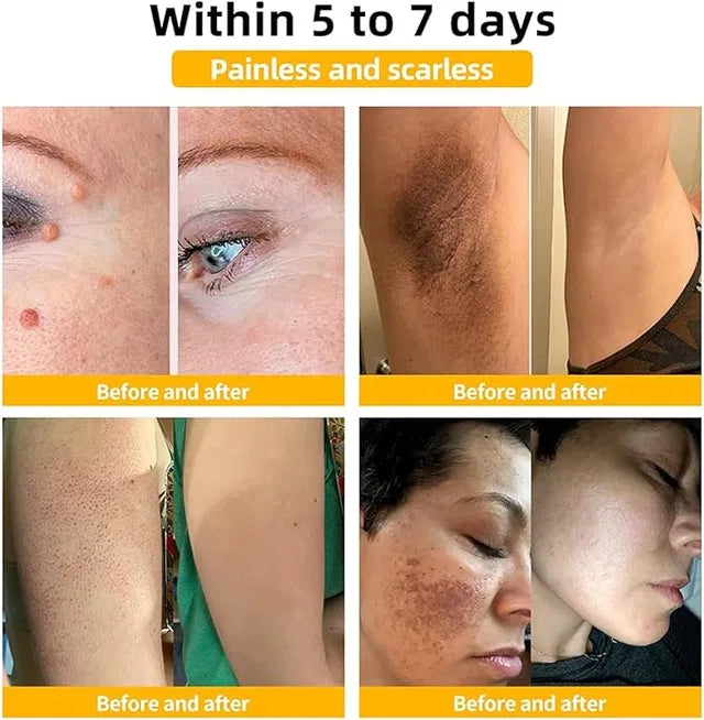 Meltdown Gel Cream for Acne-Prone Skin