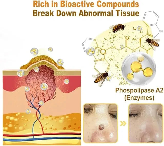 Meltdown Gel Cream for Acne-Prone Skin